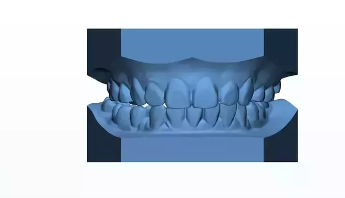 Teen Dental  Study Model 3D print model