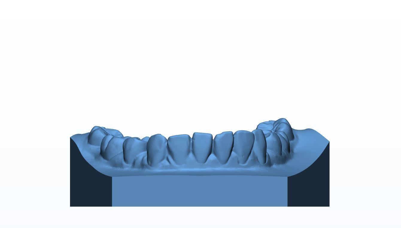 Teen Dental  Study Model 3D print model_10