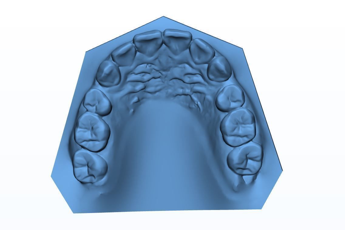 Teen Dental  Study Model 3D print model_1