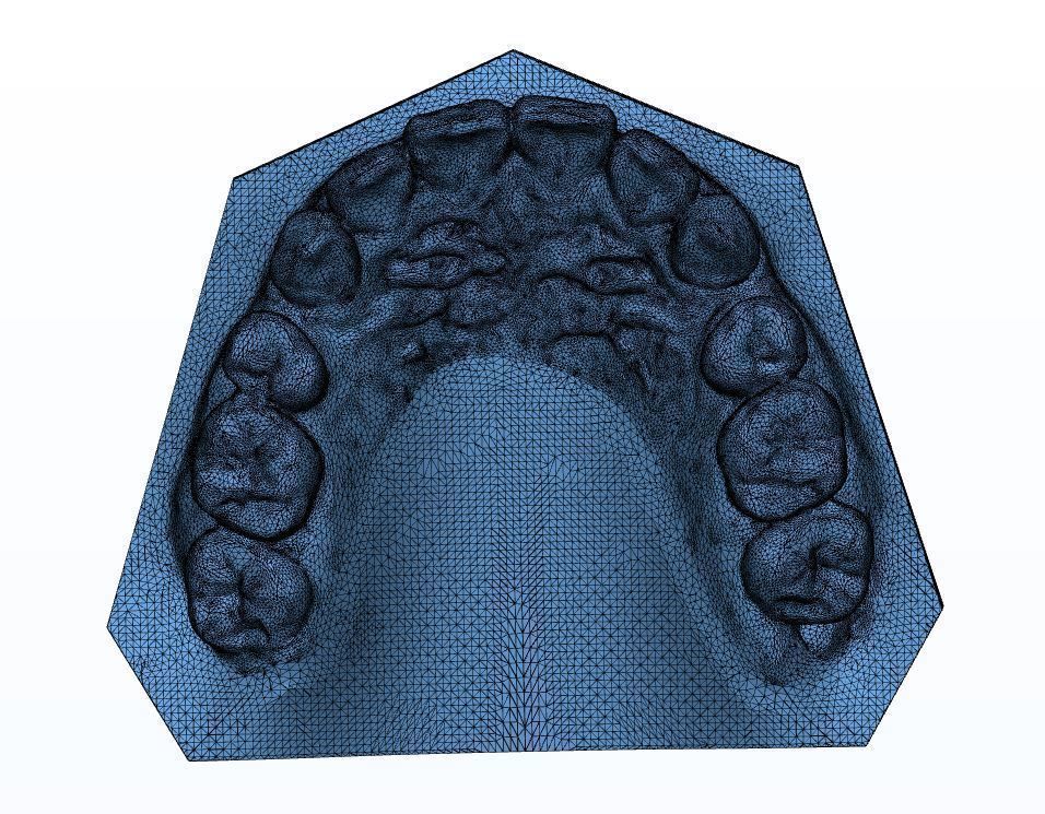 Teen Dental  Study Model 3D print model_2