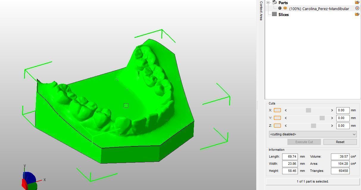 Teen Dental  Study Model 3D print model_3
