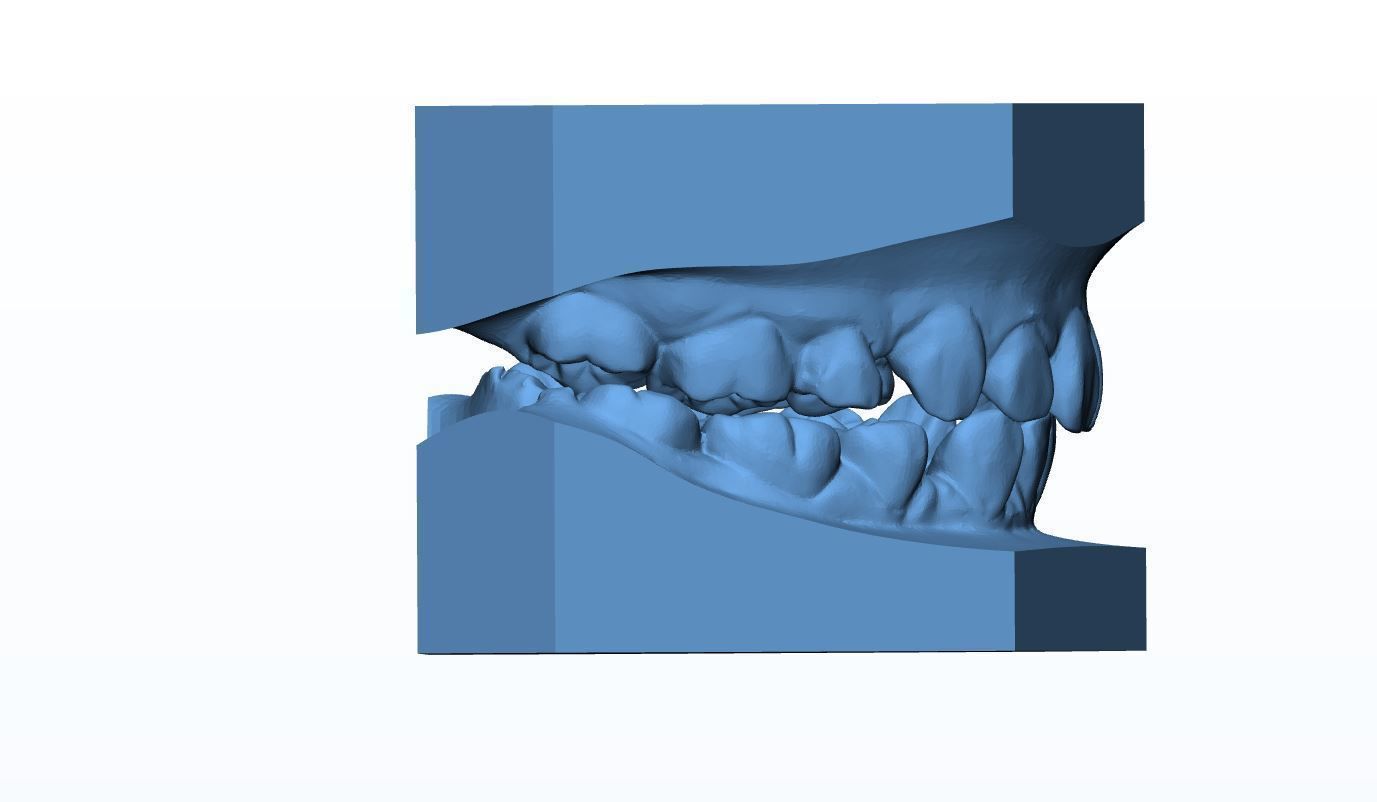 Teen Dental  Study Model 3D print model_5