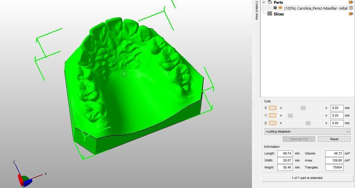 Teen Dental  Study Model 3D print model_4