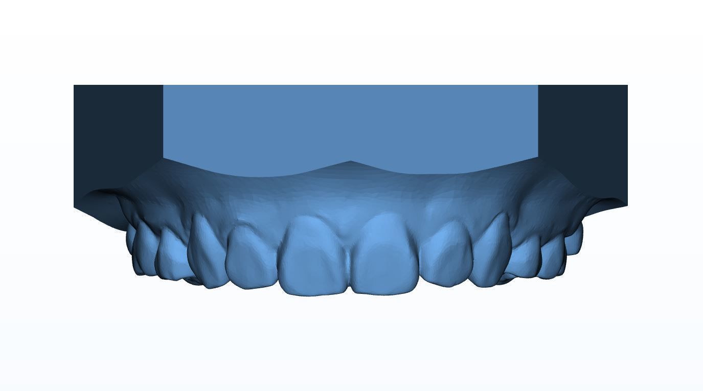 Teen Dental  Study Model 3D print model_9