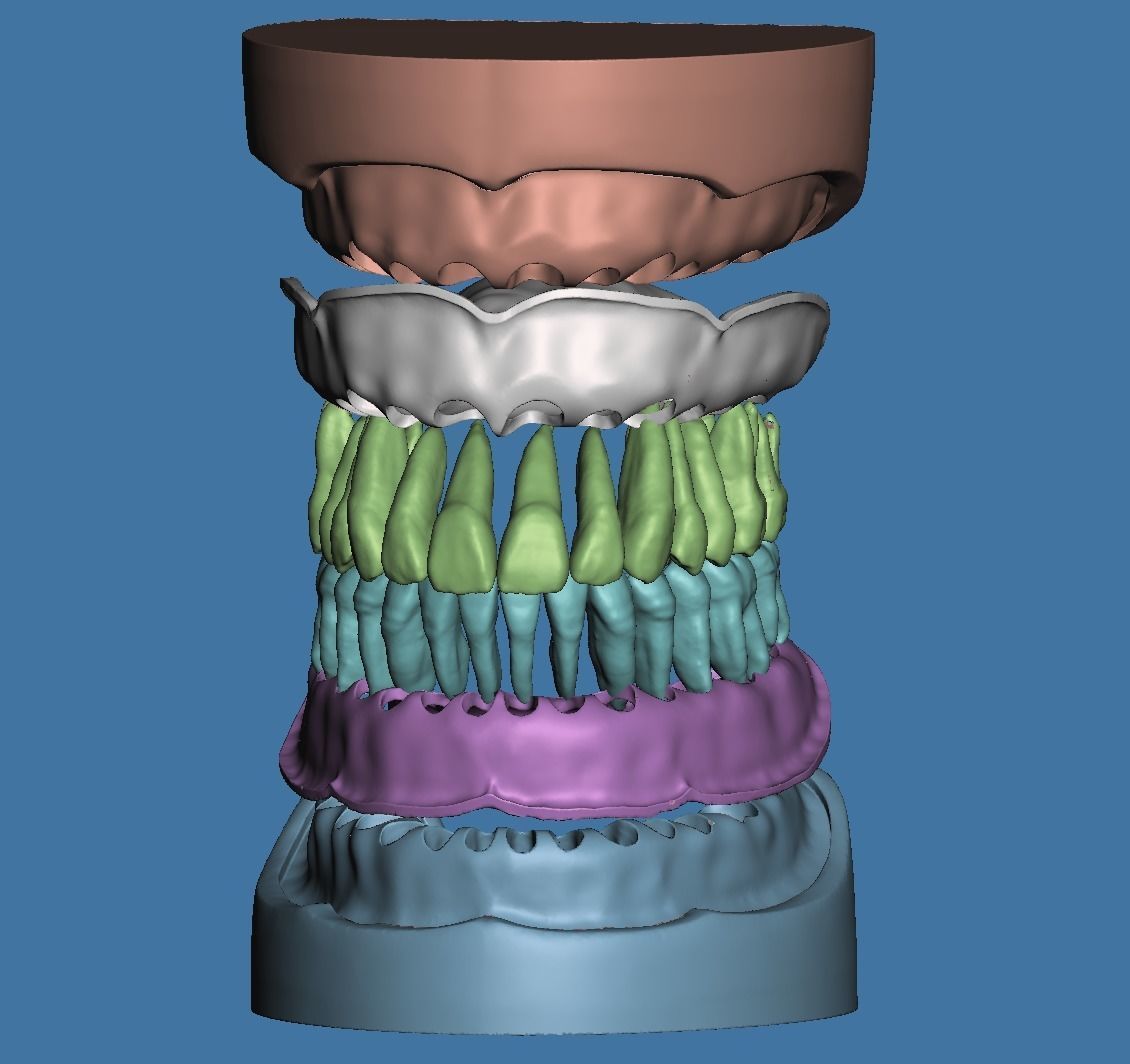 D007 Dental anatomy model with natural root and canal 3D print model_1