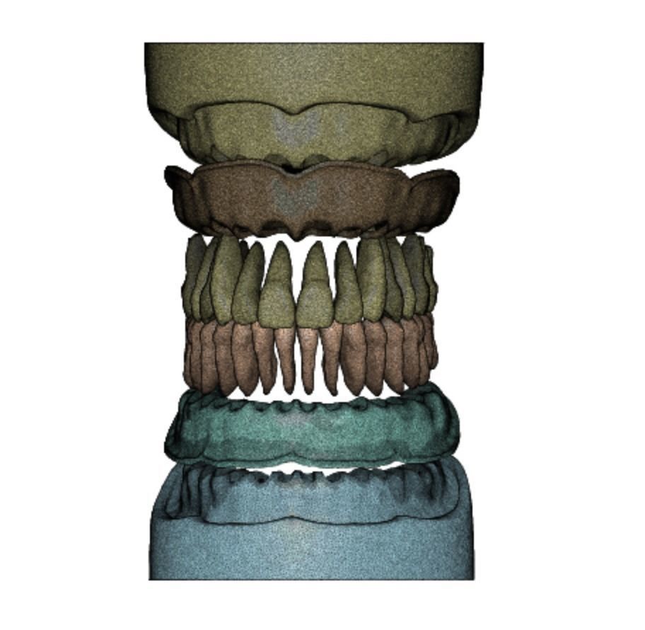 D007 Dental anatomy model with natural root and canal 3D print model_10