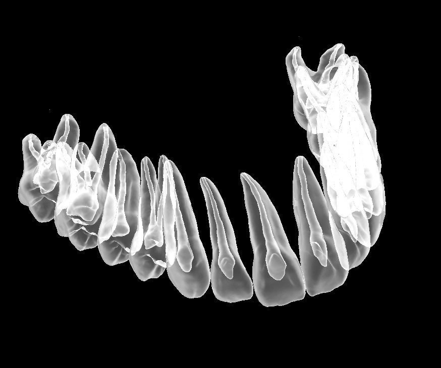 D007 Dental anatomy model with natural root and canal 3D print model_5