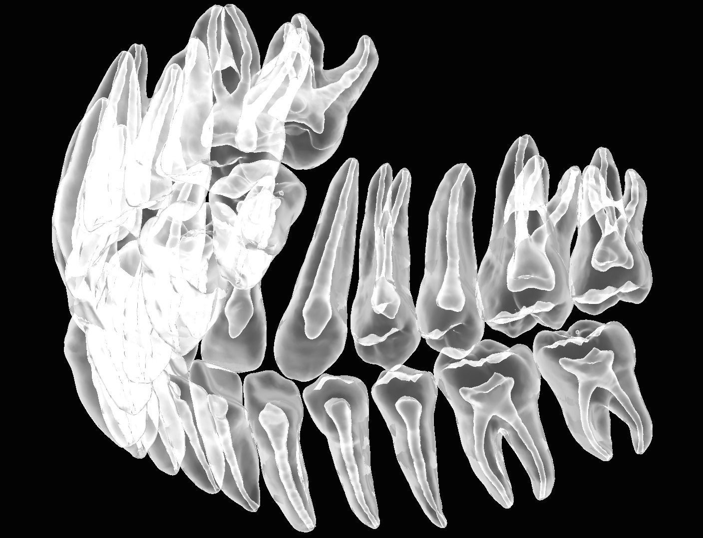 D007 Dental anatomy model with natural root and canal 3D print model_3