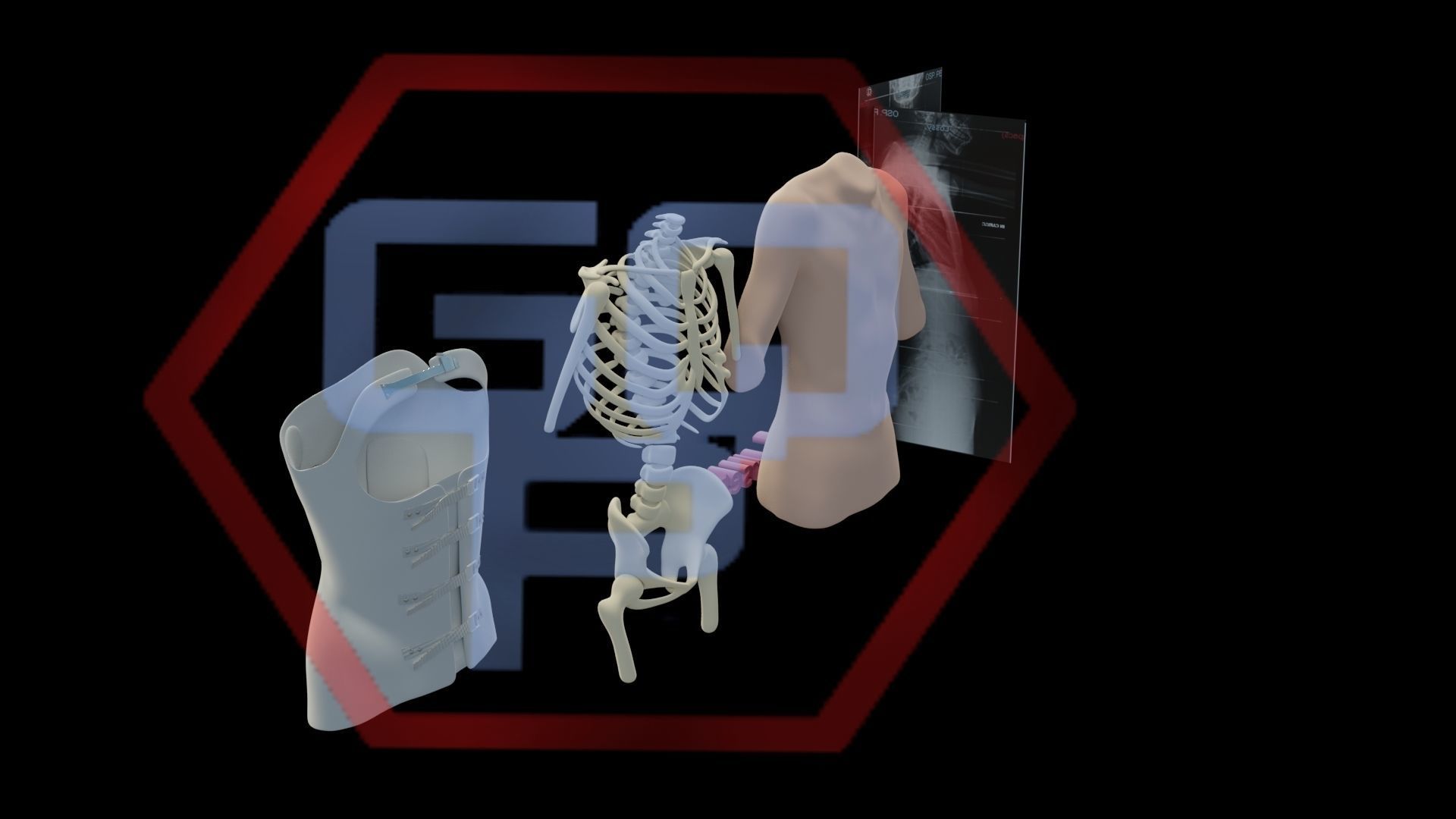 Orthopedic brace corset scoliosis animation Low-poly 3D model_9