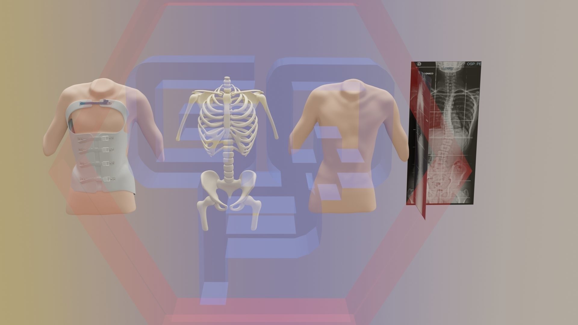Orthopedic brace corset scoliosis animation Low-poly 3D model_4