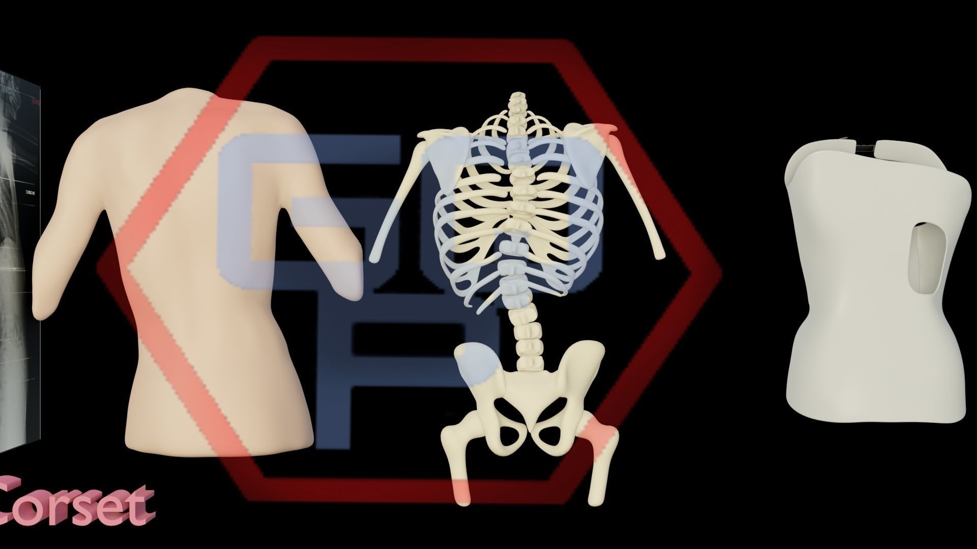 Orthopedic brace corset scoliosis animation Low-poly 3D model_13