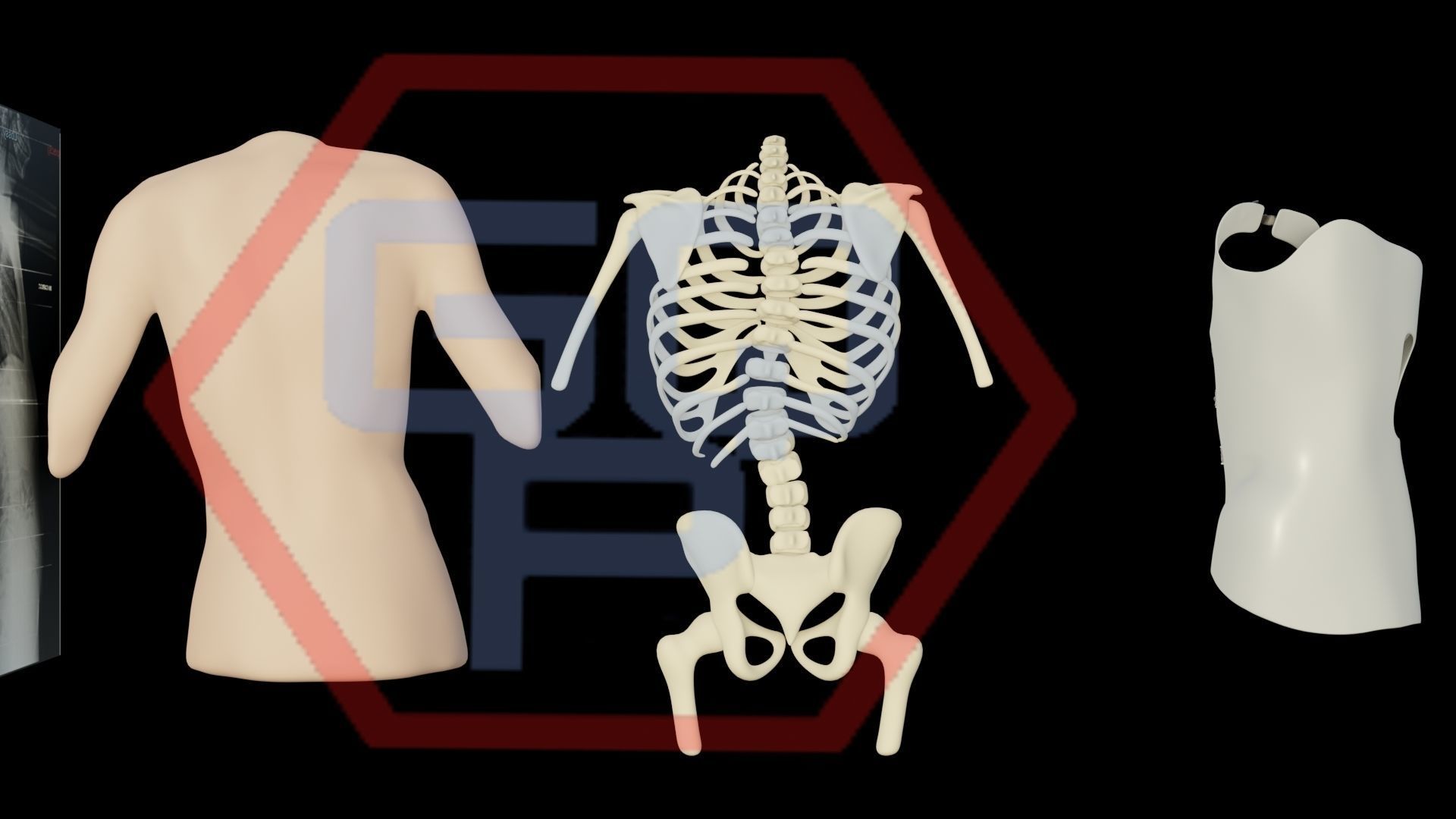 Orthopedic brace corset scoliosis animation Low-poly 3D model_12