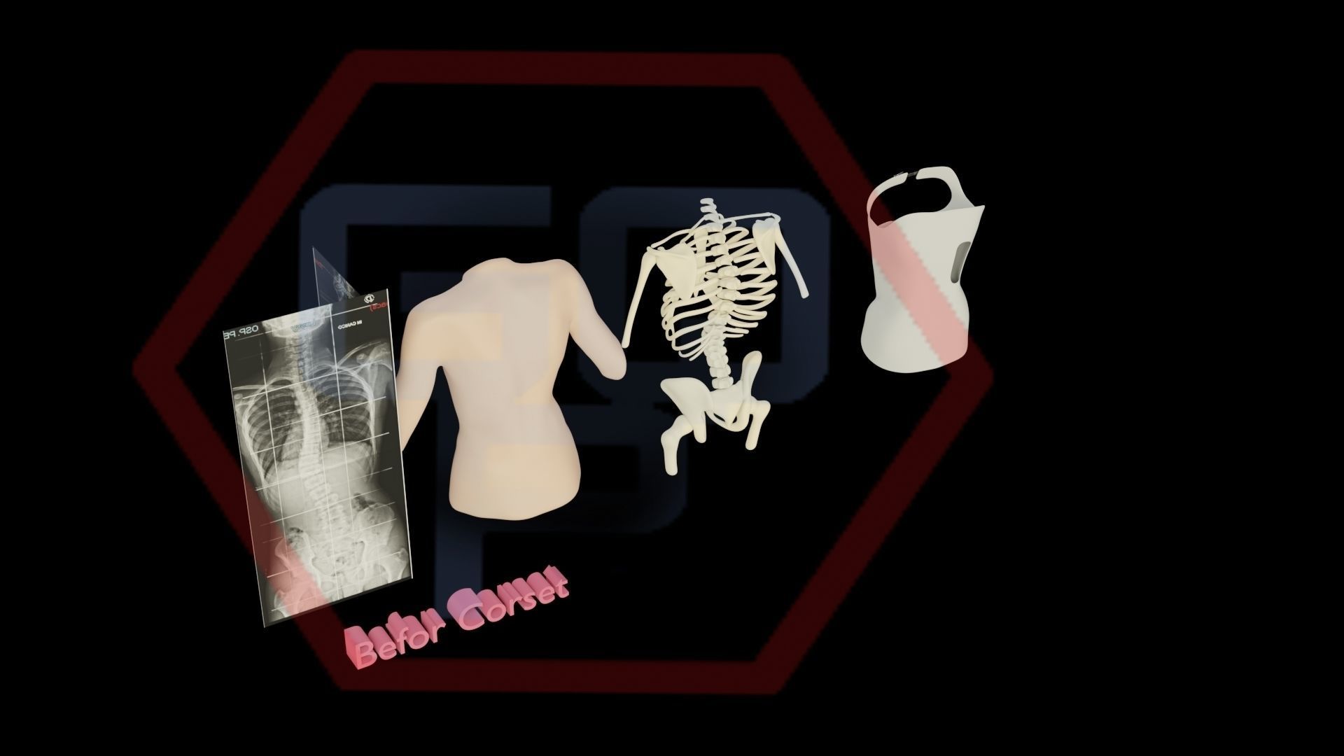 Orthopedic brace corset scoliosis animation Low-poly 3D model_16