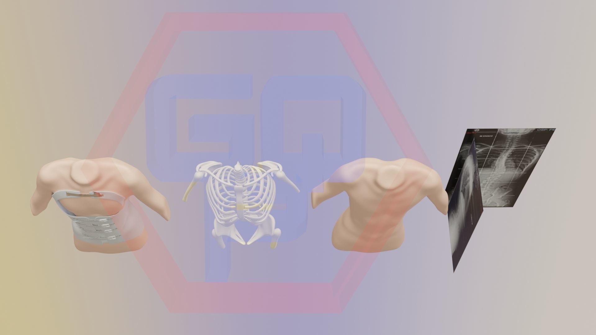 Orthopedic brace corset scoliosis animation Low-poly 3D model_3