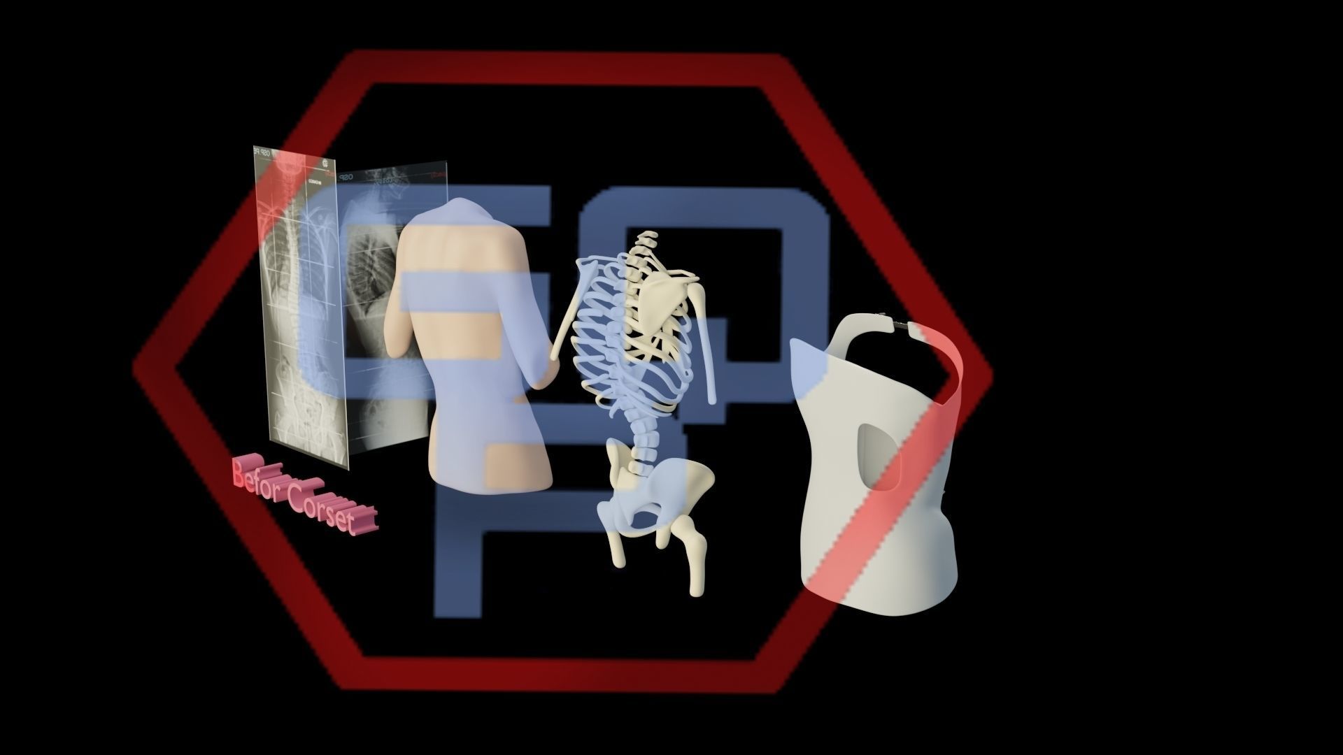 Orthopedic brace corset scoliosis animation Low-poly 3D model_15