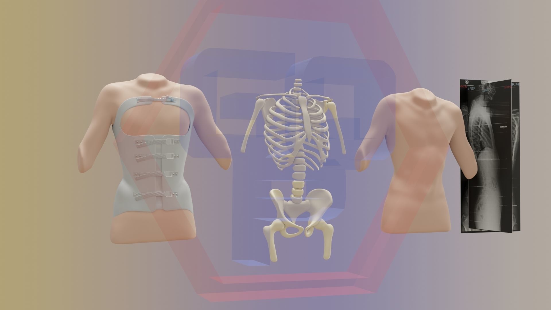 Orthopedic brace corset scoliosis animation Low-poly 3D model_2