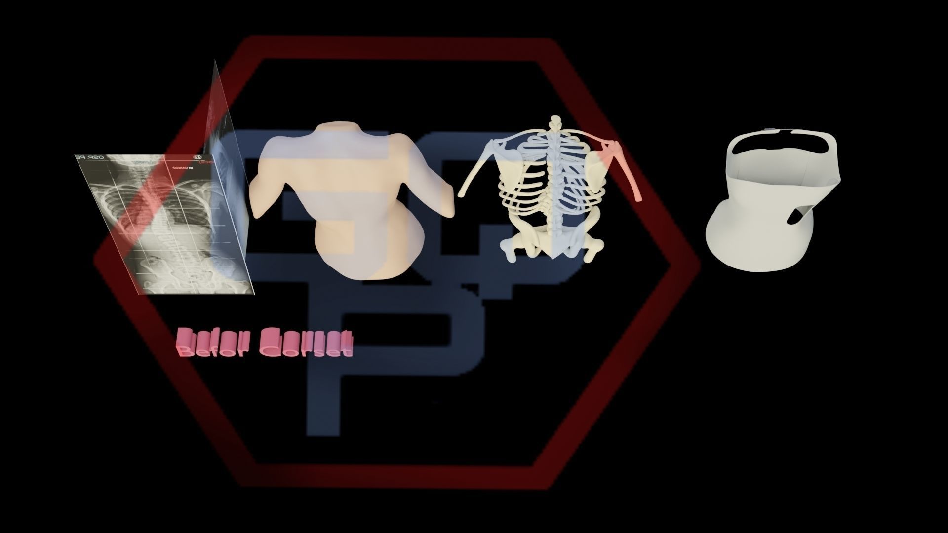 Orthopedic brace corset scoliosis animation Low-poly 3D model_17