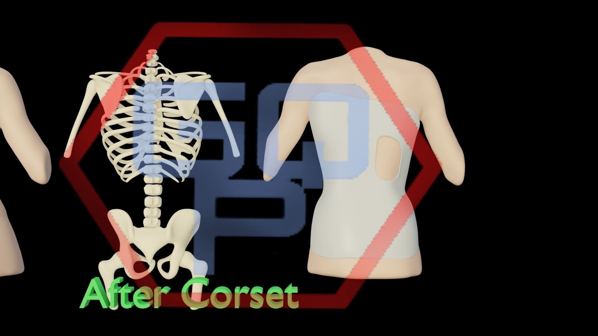 Orthopedic brace corset scoliosis animation Low-poly 3D model_14