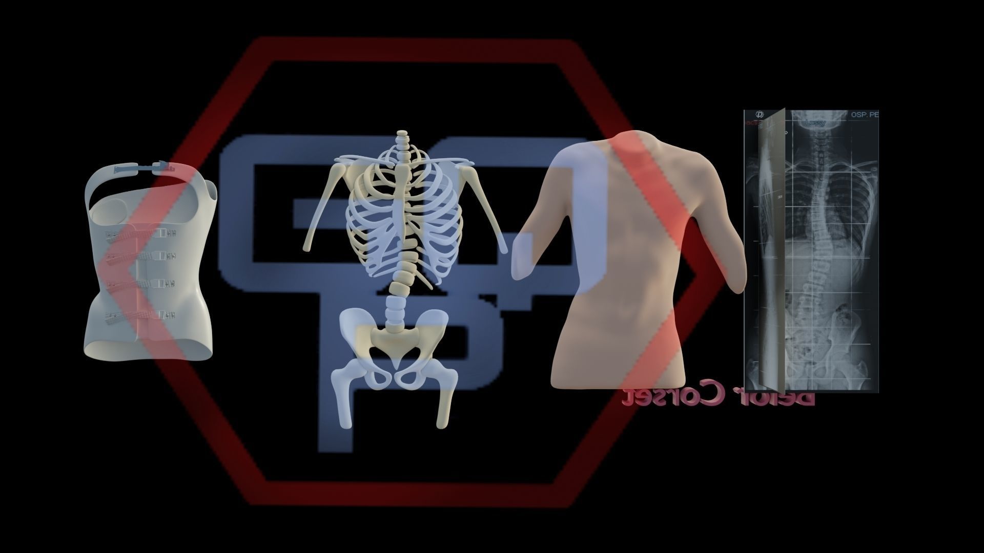 Orthopedic brace corset scoliosis animation Low-poly 3D model_6