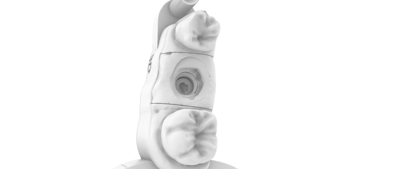 Digital Dental Implant Model with a Lab Analog 3D print model_10