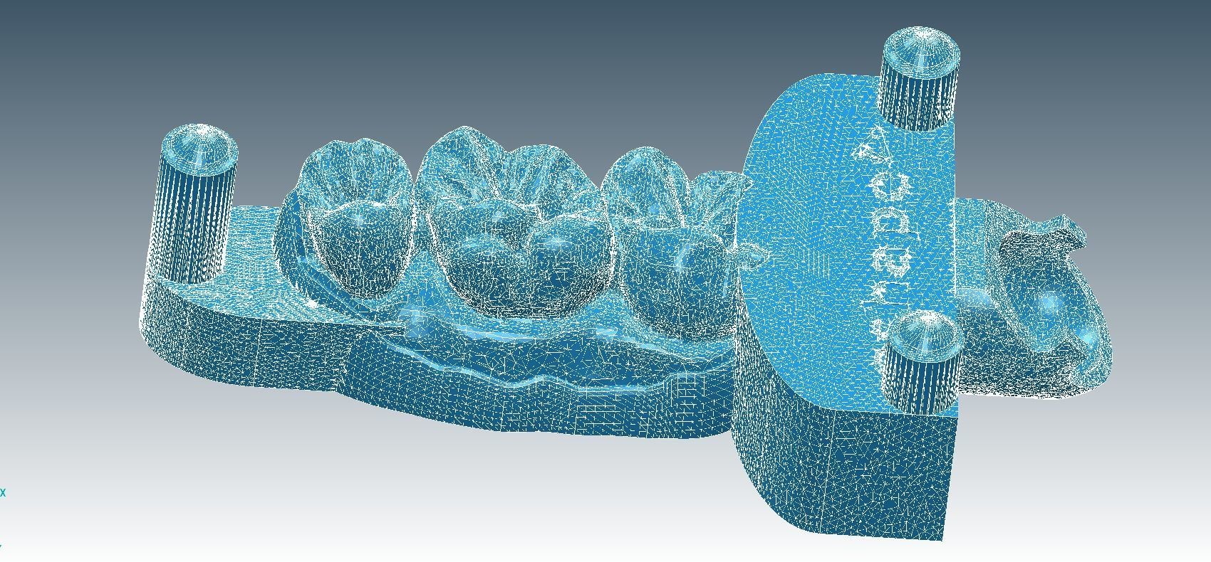 Digital Dental Implant Model with a Lab Analog 3D print model_22