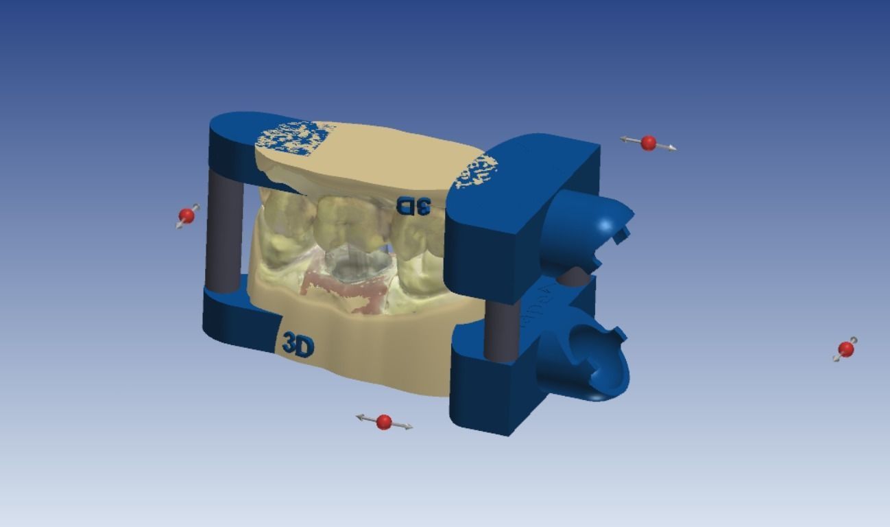 Digital Dental Implant Model with a Lab Analog 3D print model_17