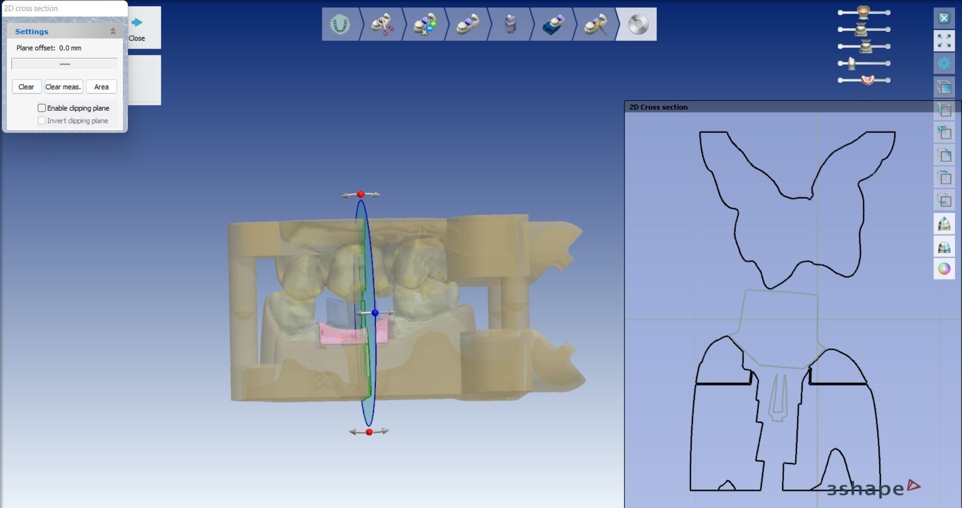 Digital Dental Implant Model with a Lab Analog 3D print model_18