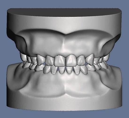 Pediatric dental model typodont type teeth 3D print model