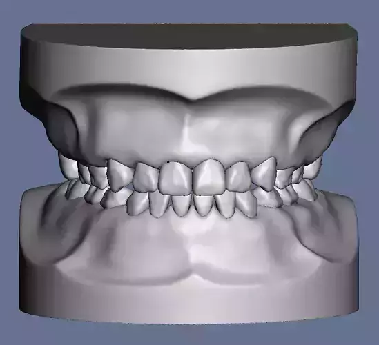 Pediatric dental model typodont type teeth 3D print model