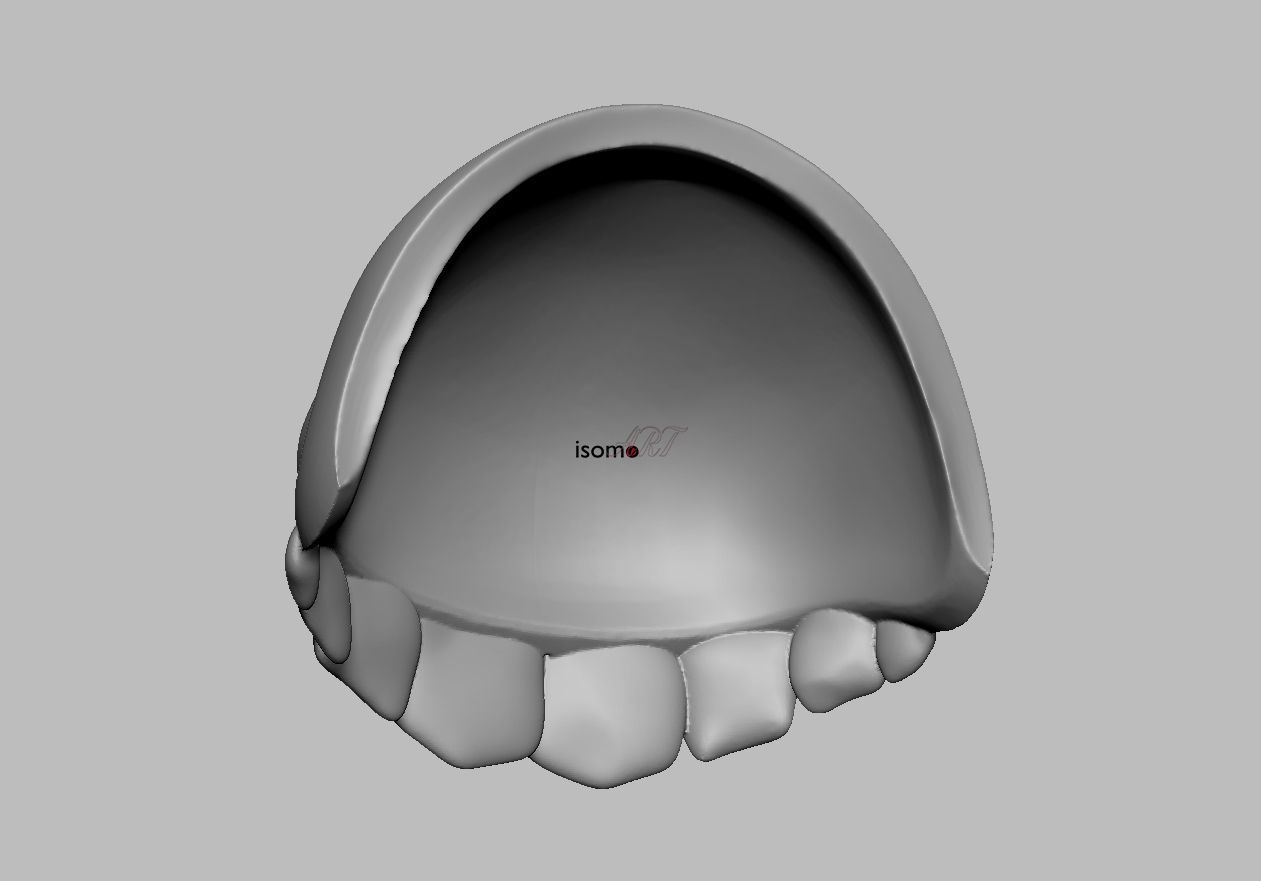 Hades Pauldron Shoulder Armor 3D Print Model Supergiant Games 3D print model_15