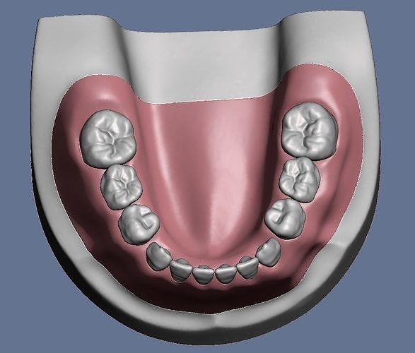 Pediatric dental model  with gum and fastening screw holes  3D print model