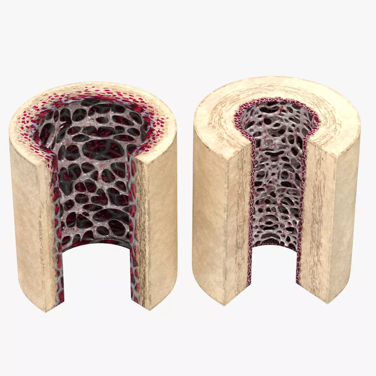 Healthy and Osteoporotic Bone Section 3D model