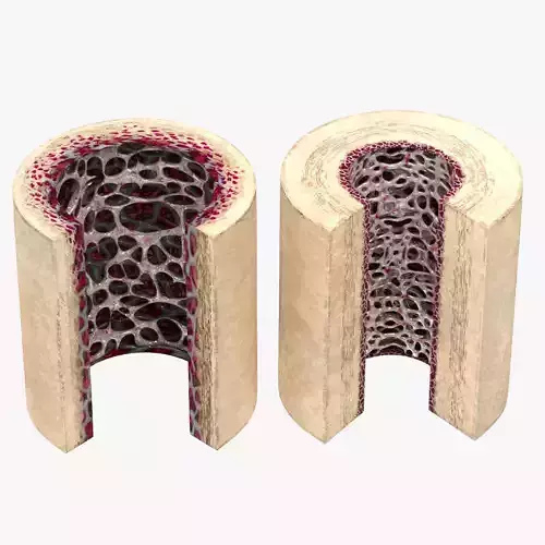 Healthy and Osteoporotic Bone Section 3D model