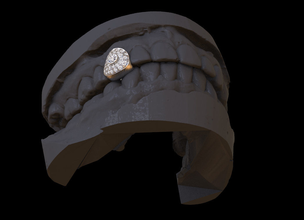 grillz tooth with gold filling 3D print model_14