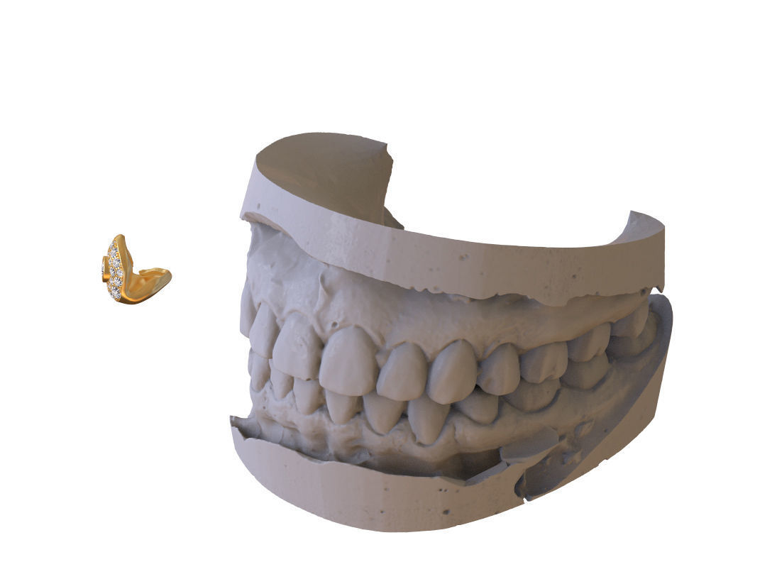 grillz tooth with gold filling 3D print model_49