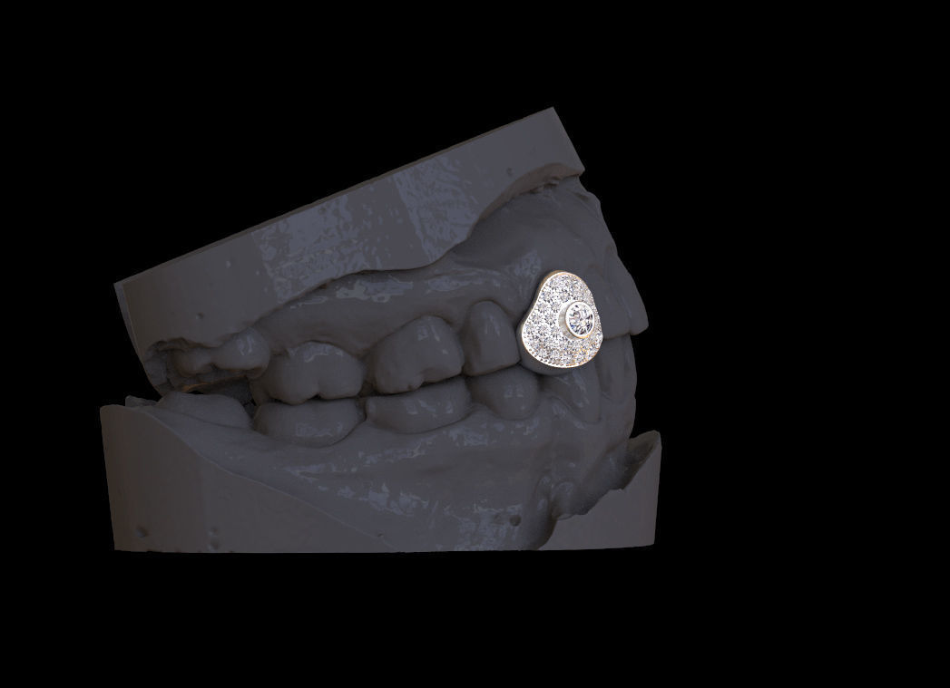 grillz tooth with gold filling 3D print model_6