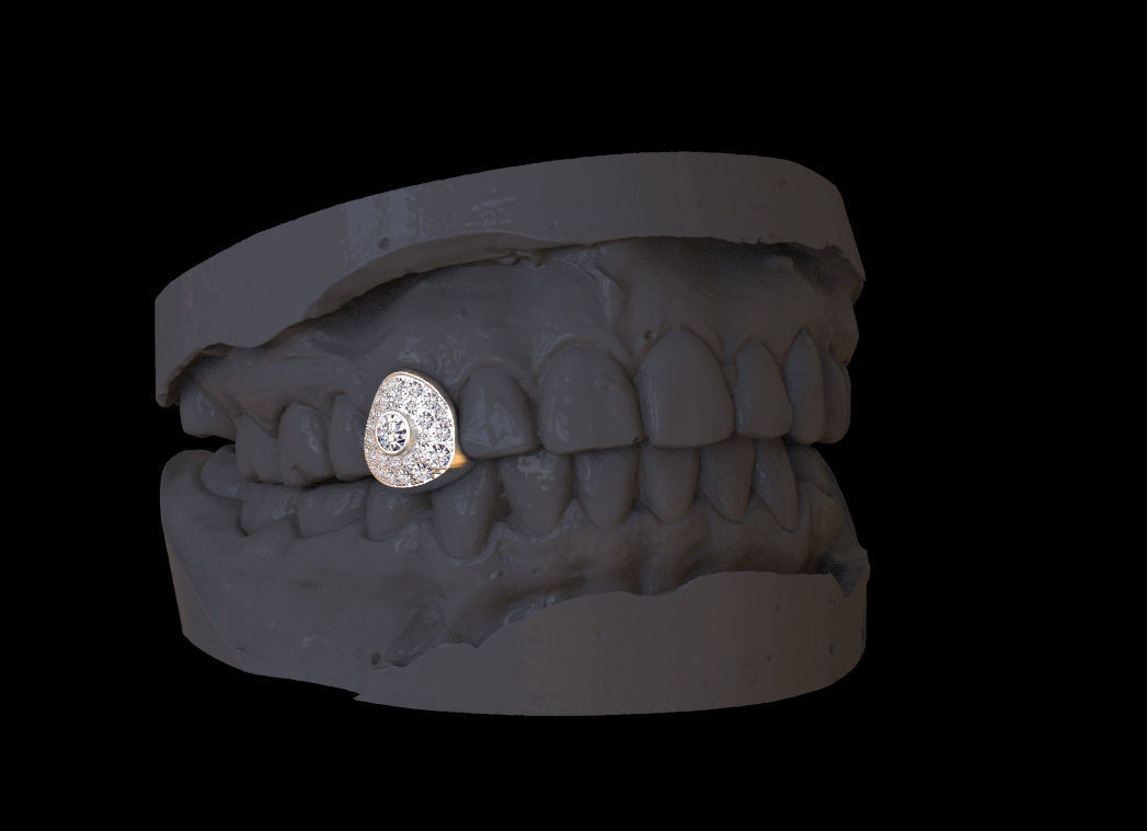 grillz tooth with gold filling 3D print model_44