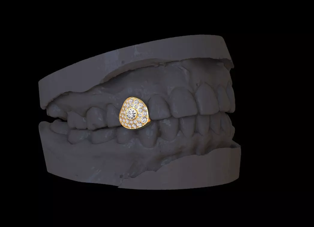 grillz tooth with gold filling 3D print model_0