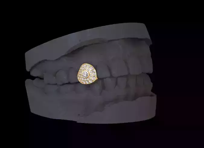 grillz tooth with gold filling 3D print model
