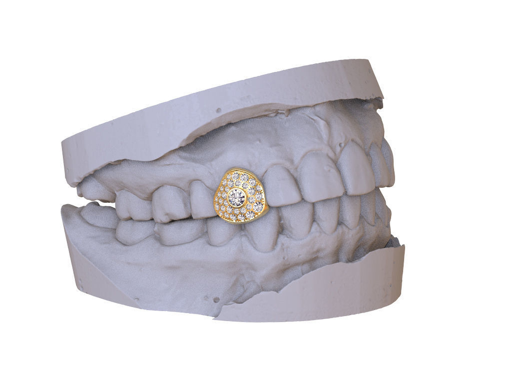 grillz tooth with gold filling 3D print model_32