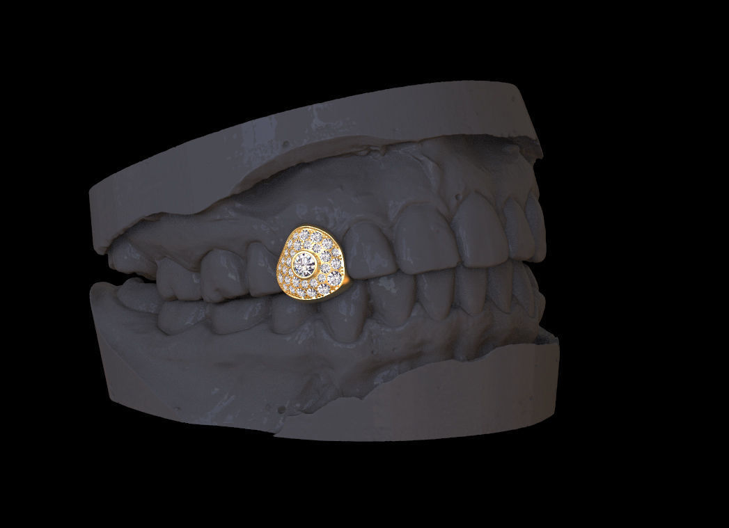 grillz tooth with gold filling 3D print model_36