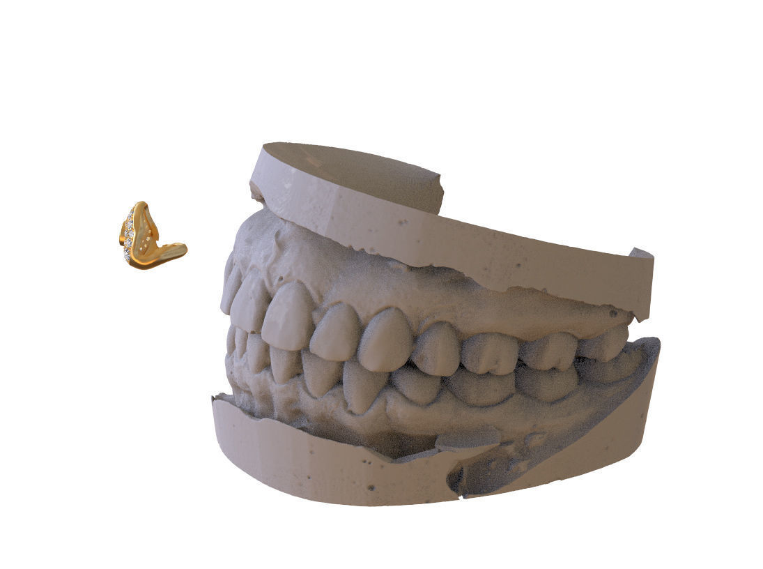 grillz tooth with gold filling 3D print model_40