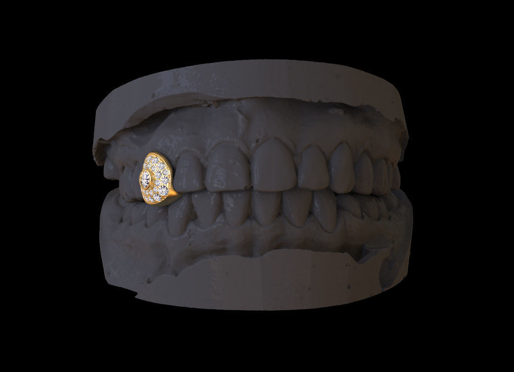 grillz tooth with gold filling 3D print model_1