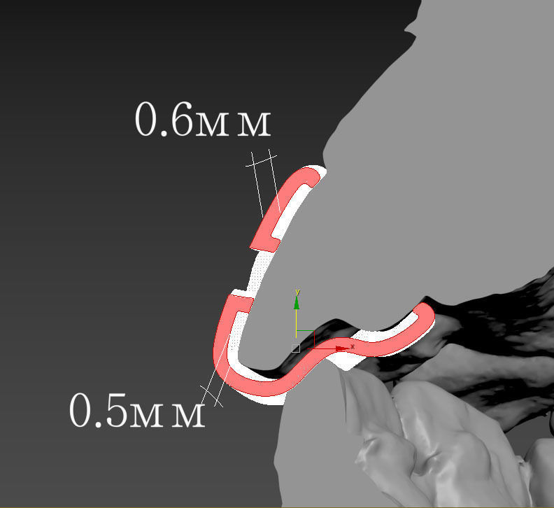 grillz tooth with gold filling 3D print model_39
