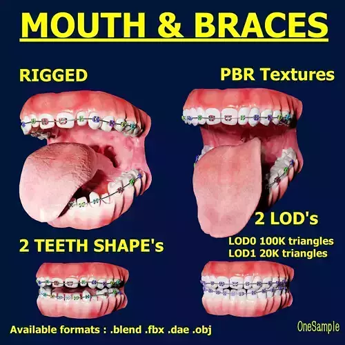 Mouth with Braces Low-poly 3D model