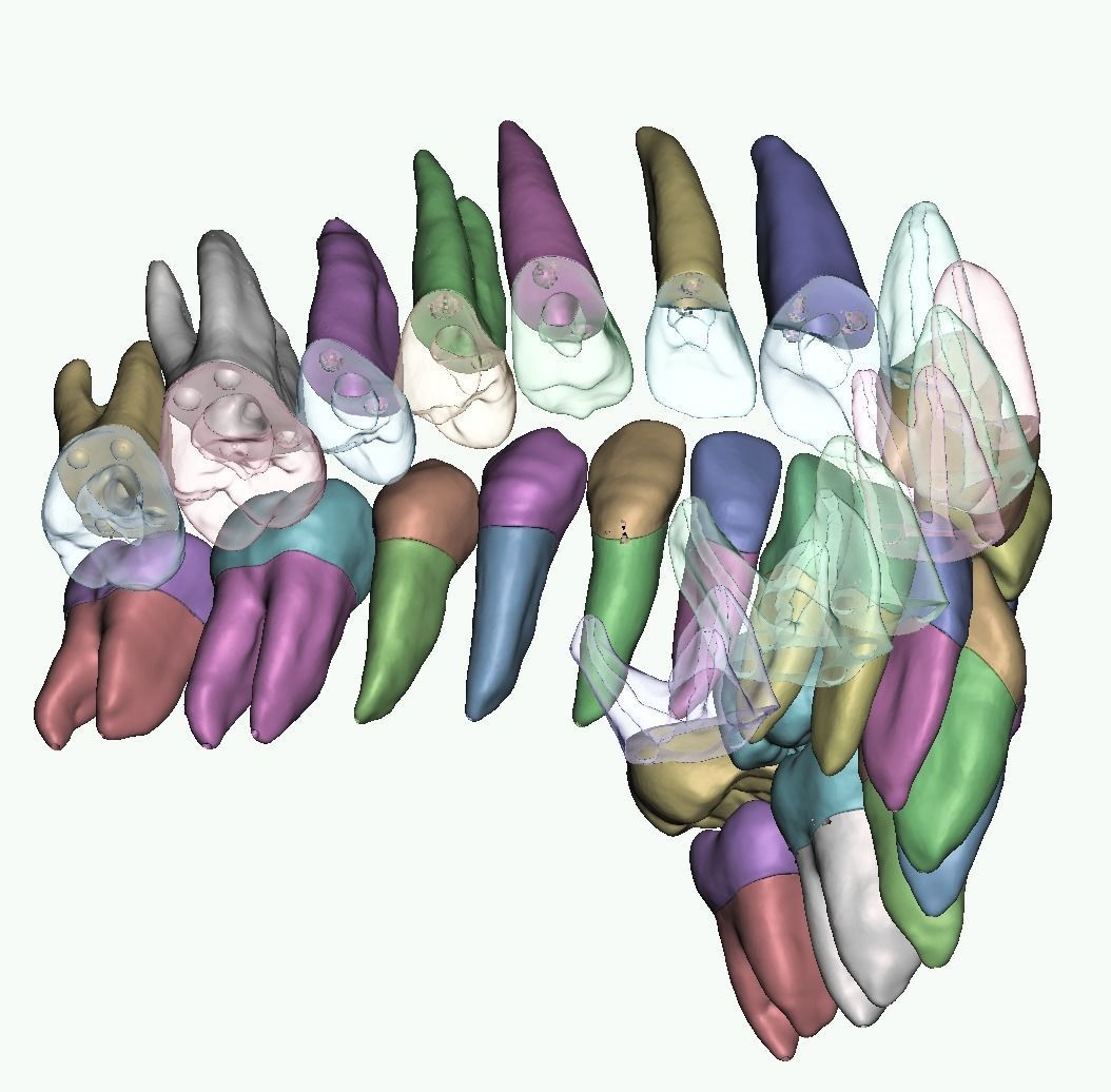 Natural anatomy teeth with root canal in 2 pieces  3D print model_6
