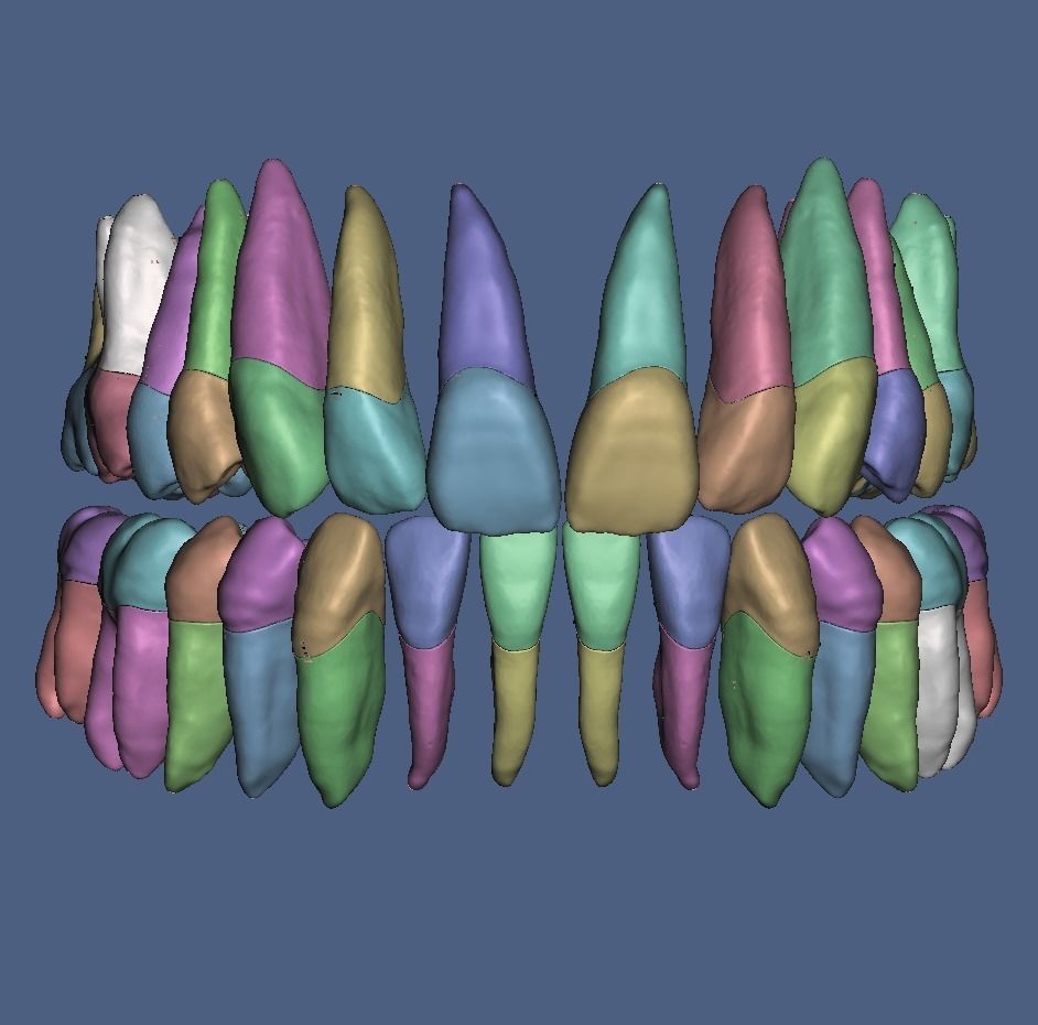 Natural anatomy teeth with root canal in 2 pieces  3D print model_18