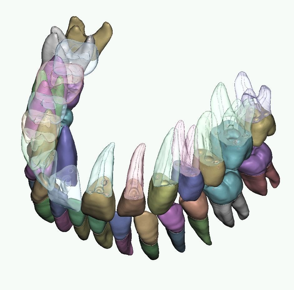 Natural anatomy teeth with root canal in 2 pieces  3D print model_7