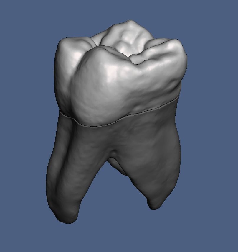 Natural anatomy teeth with root canal in 2 pieces  3D print model_17