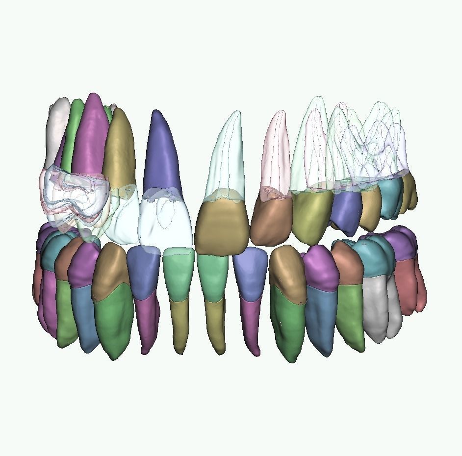 Natural anatomy teeth with root canal in 2 pieces  3D print model_3